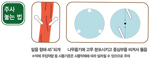 주사놓는 법